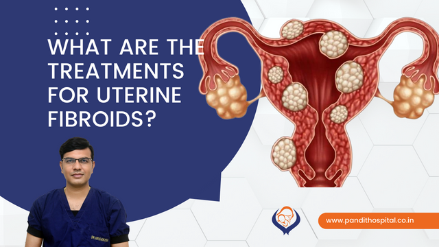 uterine fibroids treatment blog