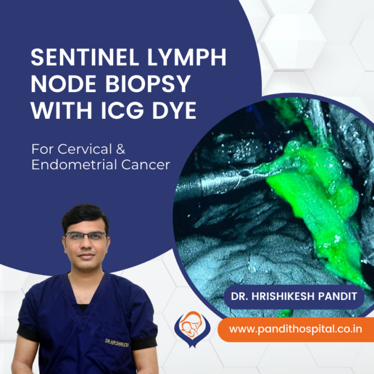 Sentinel Lymph Node Biopsy With Icg Dye In Ahmednagar