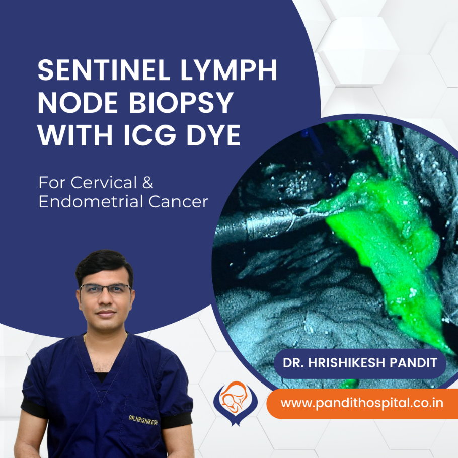 Sentinel Lymph Node Biopsy with ICG Dye in Ahmednagar