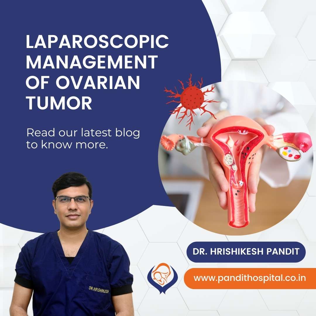 Laparoscopic Management of Ovarian Tumor
