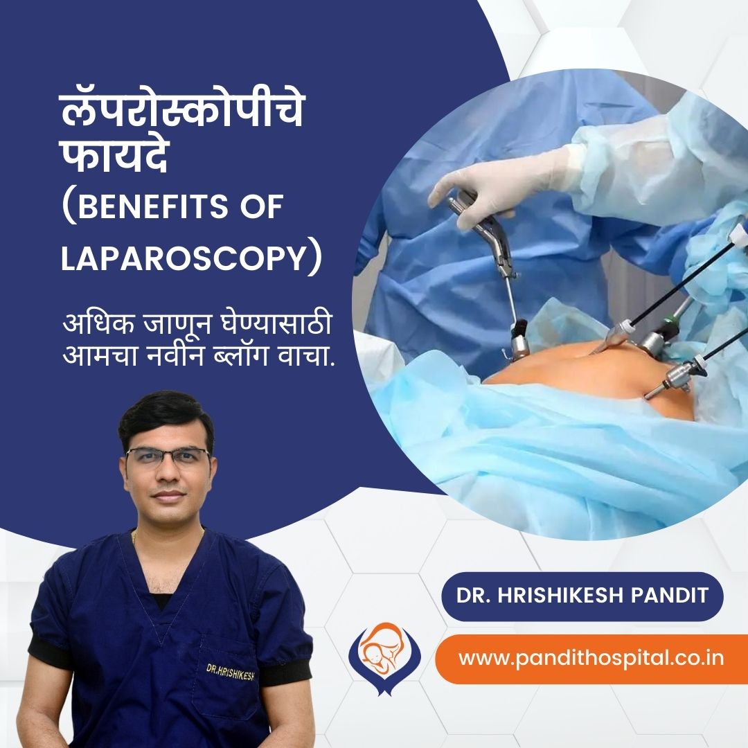 लॅपरोस्कोपिक शस्त्रक्रियेचे अनेक फायदे आहेत ✔ कमी वेदना ✔ कमी रक्तस्त्राव ✔ रुग्णालयात किमान मुक्काम ✔ जलद रिकव्हरी ✔ कमी कॉम्प्लिकेशन्स ✔ कमी टाके ✔अंतर्गत अवयवांना कमी इजा. Benefits of laparoscopy &Marathi)