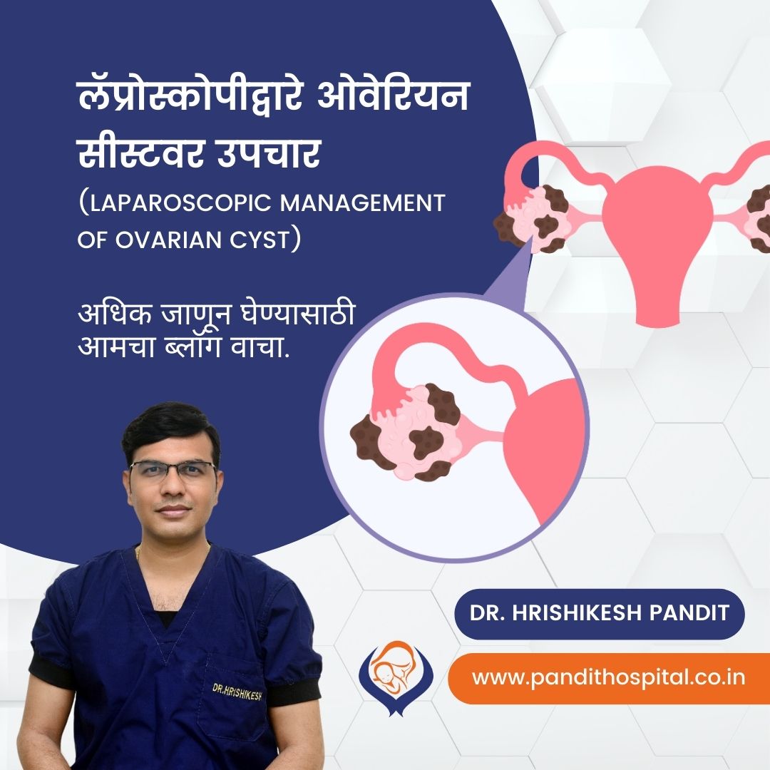 Best ovarian cyst removal doctors in India Dr. Hrishikesh Pandit (Ahmednagar)