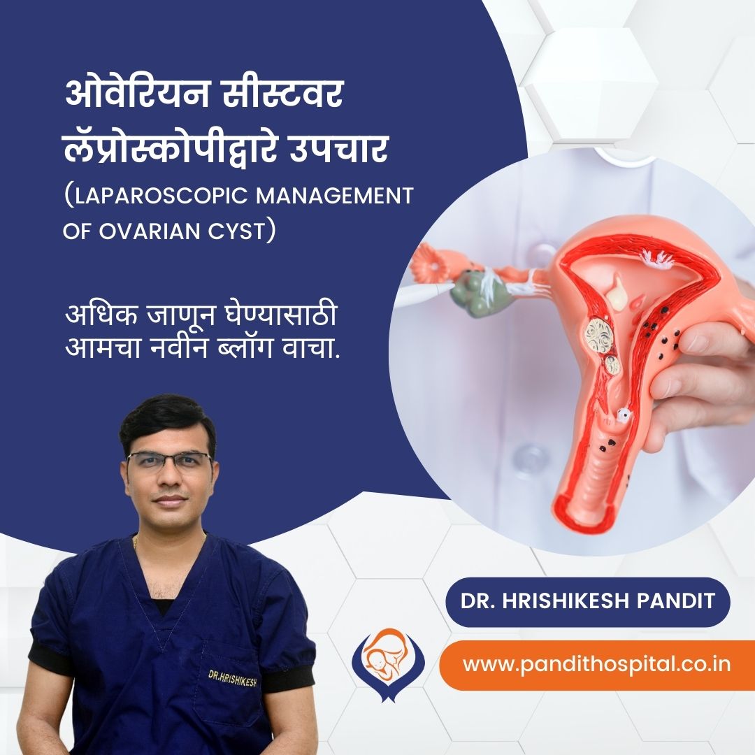 Best ovarian cyst removal doctors in India Dr. Hrishikesh Pandit