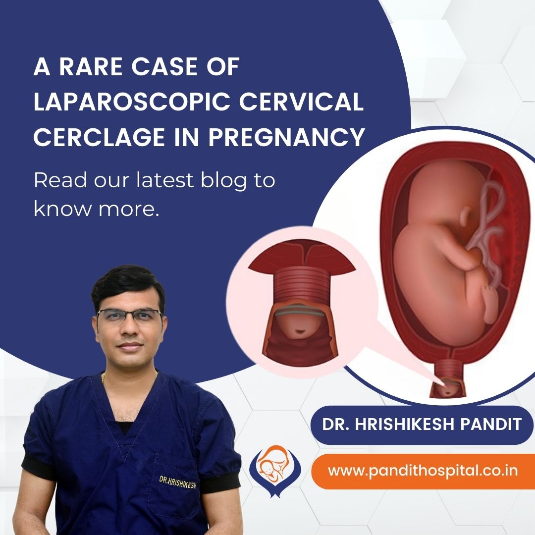 Laparoscopic Cerclage in Pregnancy | Ahmednagar | Ahilyanagar